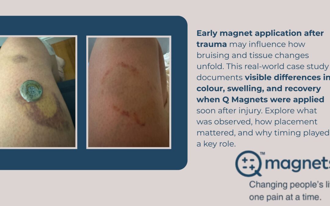 What Happens When Magnets Are Applied Early After Injury?