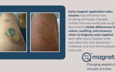 What Happens When Magnets Are Applied Early After Injury?