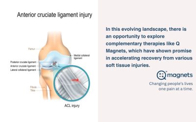 Supporting ACL Recovery in Athletes with Q Magnets: A Non-Surgical Perspective