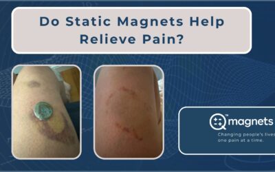 Do Static Magnets Help Relieve Pain?