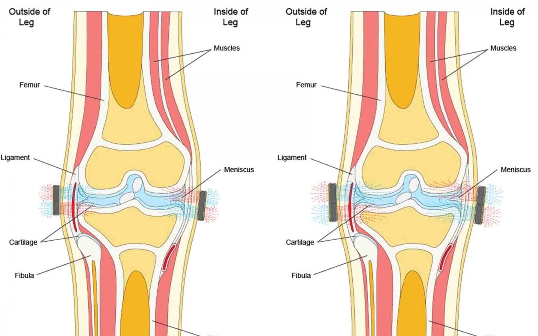 Illustration Magnetic Field Lines on Knee Joint