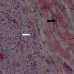 Magnetic therapy and tendon healing support