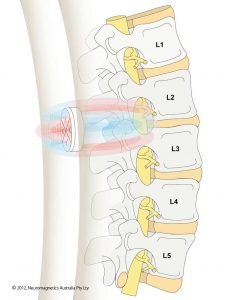 Magnetic therapy device for lower back pain