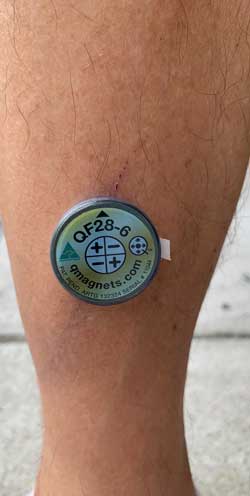 magnetic therapy soft tissue injury bruise healing shins