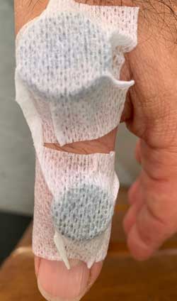 Magnets applied to thumb strain
