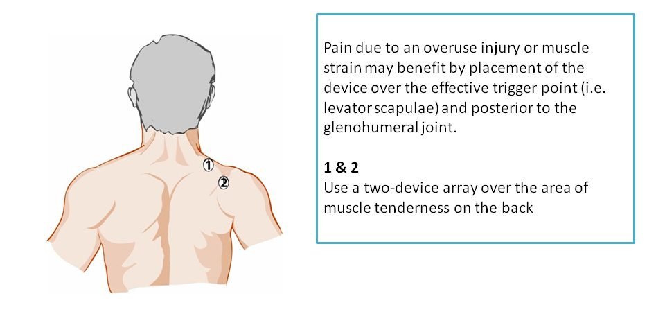 acute shoulder pain treatment