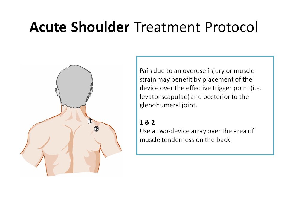 Acute Shoulder Pain Relief Magnets - Severe - QF28-3x2 - Magnetic therapy