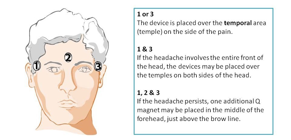 headache and migraine magnetic therapy