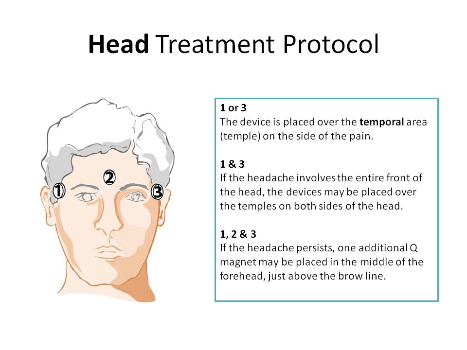 Magnetic therapy for Headaches and Migraine