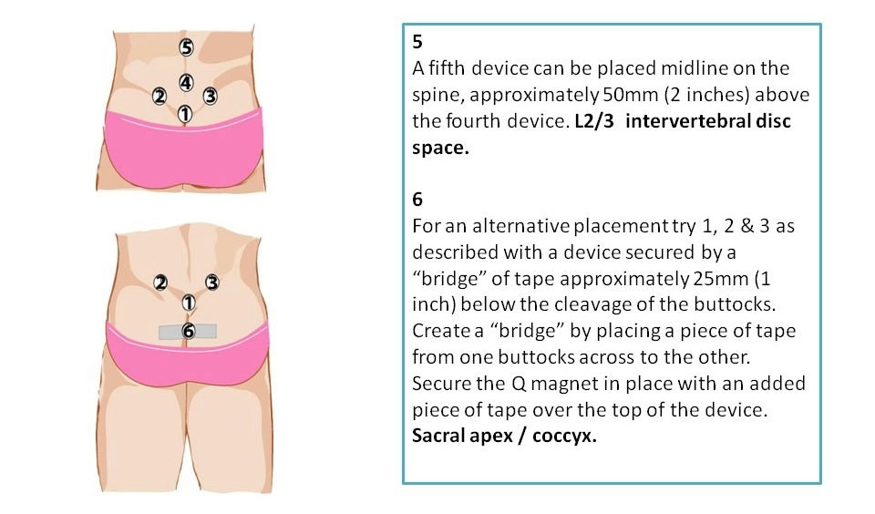 Lower Back Pain Treatment using Magnetic Therapy Magnets