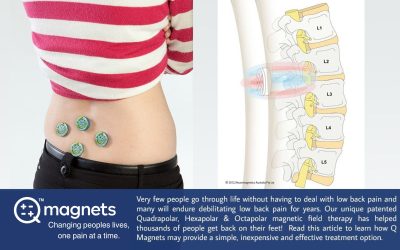 Magnetic Field Therapy for Low Back Pain
