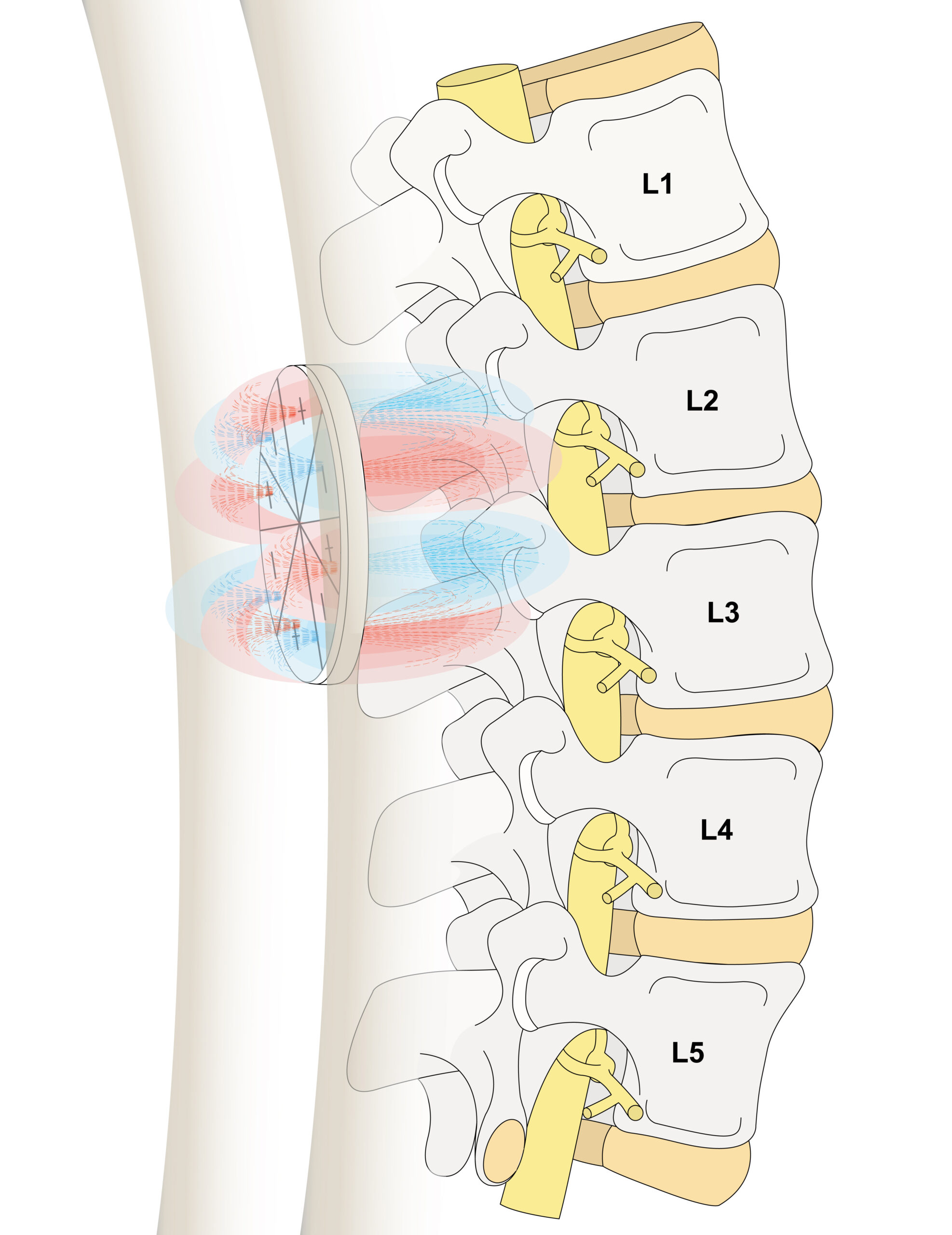 Magnetic Therapy for low back pain with Octapolar Q Magnets