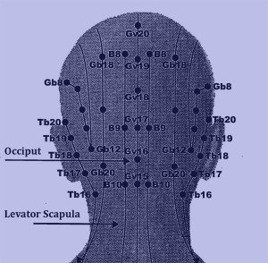 magnetic therapy acupuncture points for headaches and migraine treatment
