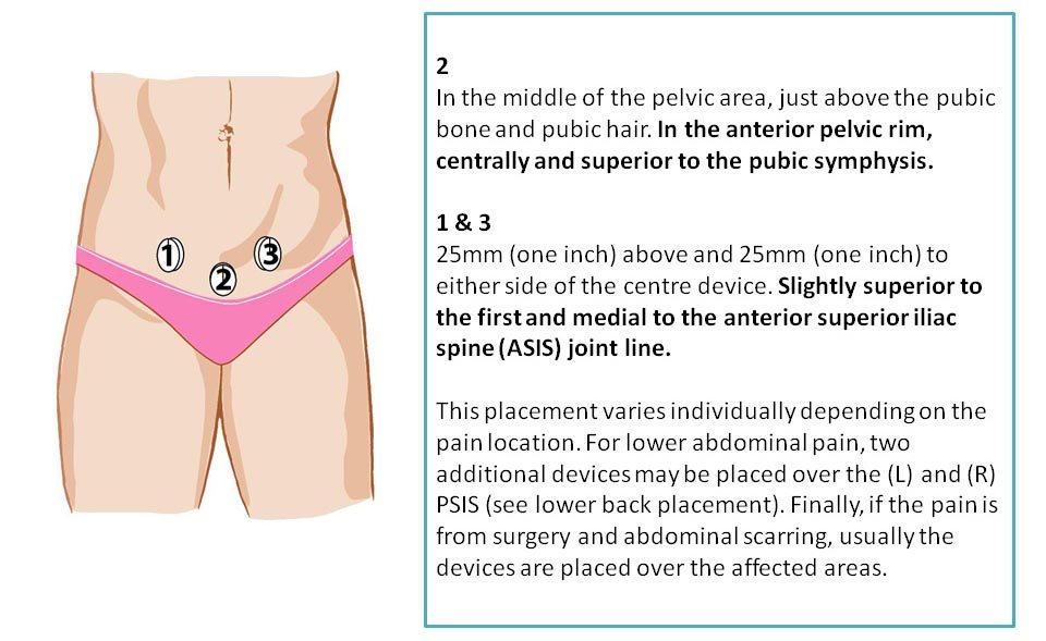 stomach ache treatment with magnetic therapy - menstrual pain pelvis pain treatment