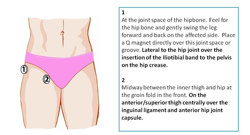 Hip Pain Relief Magnets - Magnetic Therapy Treatment Protocol