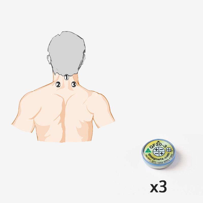 Neck/Shoulder Pain – Three-Point Cervical Placement – 20 mm Magnet Configuration. 3 x QF20-3