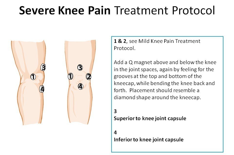 magnets can be helpful for knee pain relief