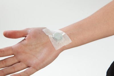 Magnet placement for carpal tunnel syndrome